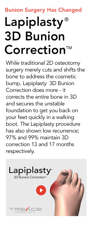 Lapiplasty 3D Bunion Family Footcare Connecticut